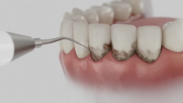 Reliable Dental Implants contractor in Gilbert, AZ by Smile Center Dentistry